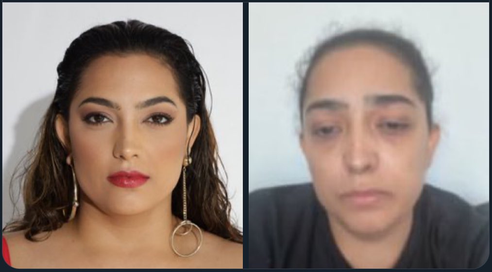 kleysller's tweet image. A diferença entre você ter uma #marcaregistrada ®️ x marca sem registro #bbb24 ex do #calabreso