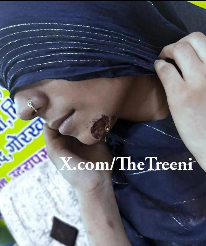 SaffronSunanda's tweet photo. **Love Jihad Is a sad truth**

Aftab Alam ( 28) tricked and trapped a 17 year old minor Hindu girl and ran away with her to Surat , Gujarat from Bihar.

As usual he forcefully converted her to Islam and gave her a new name Saiba Khatun. 

He beaten and tortured her for not reading #Quran and Namaz. And he made her go under two abortions too.

Somehow Bajrang Dal rescued her and Aftab Alam is arrested now.

Hinduphobia is real!!