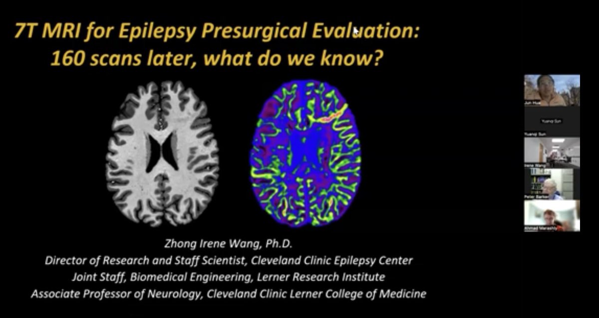 irenezhongwang's tweet photo. 👩🏻‍🏫 Extremely happy and honored to talk at the 7T lecture series at Kennedy Krieger Institute and Johns Hopkins, sharing our studies using #7TMRI and post-processing for #epilepsysurgery. Check out the recording and fantastic list of speakers on YouTube: 👉 https://t.co/hQGHoKTt1F https://t.co/yz2DUW34k6