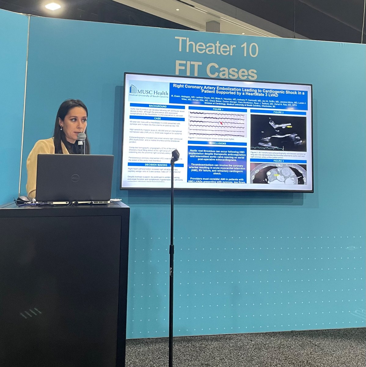 Congratulations to @MUSCCardFellows Adv HF fellow @EcemAkdoganMD on her #ACC24 presentation this past weekend on a rare but important thromboembolic complication in HM3 LVADs causing RV failure. Incredible work by our heart failure team at @MUSC_Cardiology