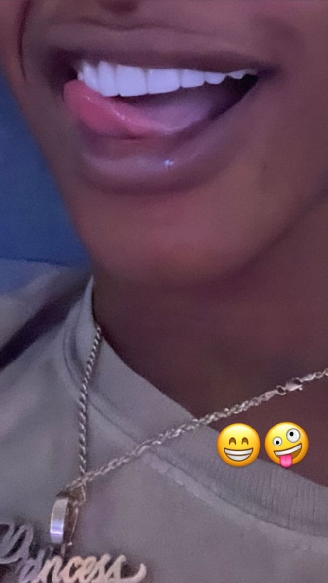 pthabiggest's tweet image. 😁✨ all mine #ColgateSmile