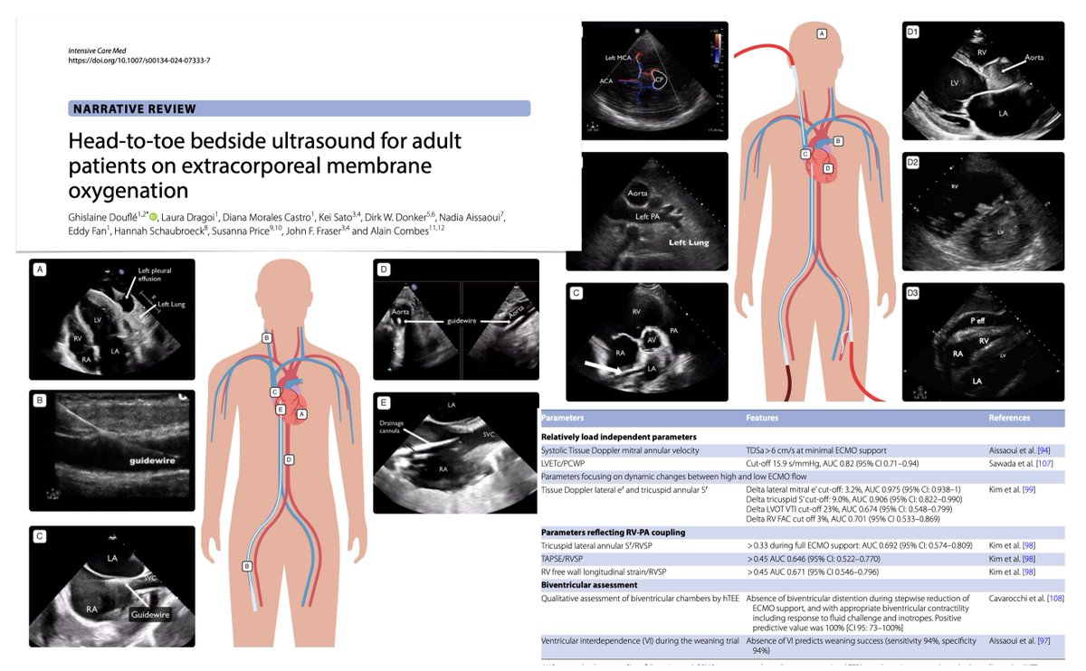 Head-to-toe bedside #ultrasound for adults on #ECMO 🔓 rdcu.be/dEpOA 🫀🫁 prior to ECMO initiation: echocardiography, indications-contraindications + choice of configuration, pre-cannulation findings, LUS 🚨 #POCUS during #ECPR 🖥️ procedural guidance: vascular access