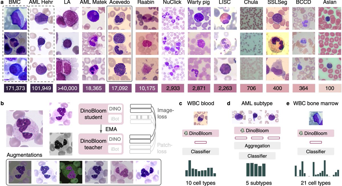 Excited to introduce DinoBloom🦖🌺, an open-source foundation model family (Vit-S to G) for general cell embeddings in #hematology🩸 Trained w mod. #DINOv2 on 13 datasets w 380,000+ WBC images of blood & bonemarrow. Evaluated on AML subtype & cell classification (knn, lin probe)
