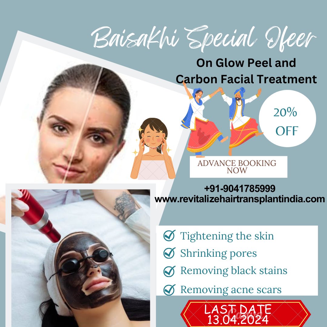 Baisakhi Special Offer On Glow Peel and Carbon Special Treatment!!!!

WhatsApp : wa.me/919041785999
Visit Now : revitalizehairtransplantindia.com
Call us: (+91) 90417-85999
#skintreatment #skintreatments  #facetretment  #facecare #carbonfacials  #carbonfacialpeeling  #glowpeel  #