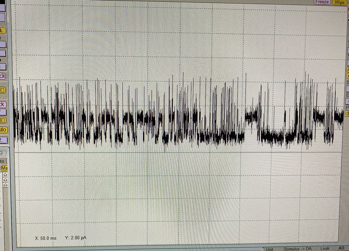 I haven’t done any electrophysiology on rotavirus NSP4 in several years…nice to know that I still got it. #viroporin #calciumsignaling #ephys #ionchannels