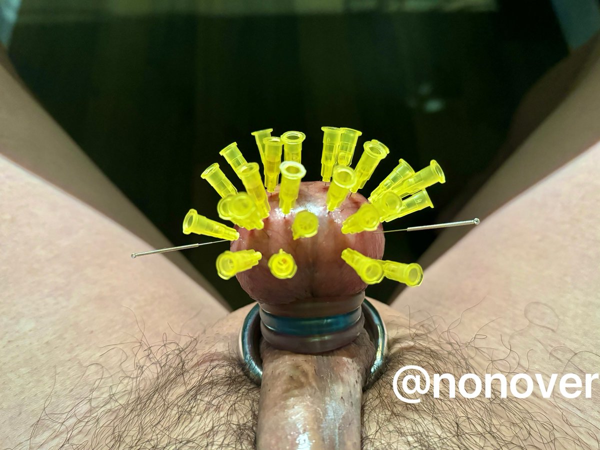 慎点！！！有针
昨晚自己玩了下，如果不是针用完了，估计还能扎，太爽了，特别是今天感觉精神特别好
感谢内啡肽