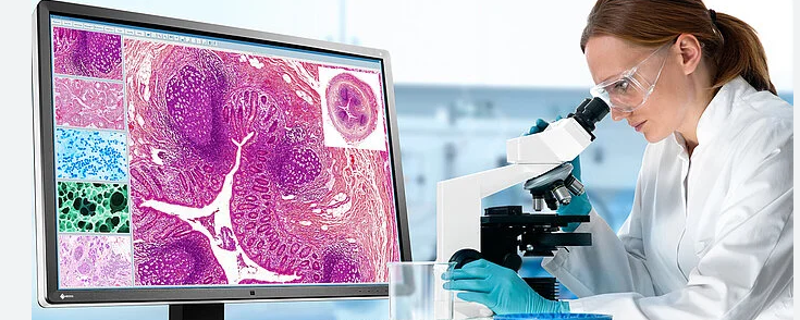 ScitechPtyLtd's tweet image. Are you in need of a #microscopecamera for #pathology🔬?

Pixelink M-series cameras combine large field of view, high speed live previews, simple sample manipulation &amp;amp; superb colour reproduction. Offering 2MP to 20MP resolution. #highresolutionimaging #brightfield
#darkfield