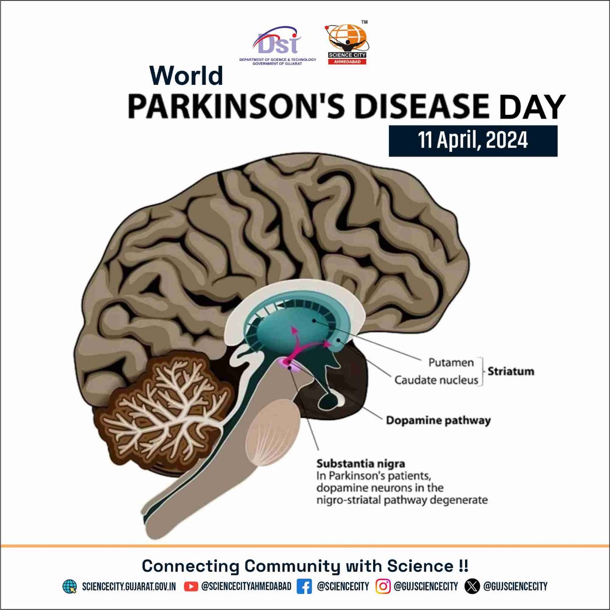 Today, Gujarat Science City stands with the global community in raising awareness for Parkinson's Disease. Let's unite to support research, advocate for better treatments, and enhance the lives of those affected #chalosciencecity @indiadst @dstgujarat @jbvadar @InfoGujarat