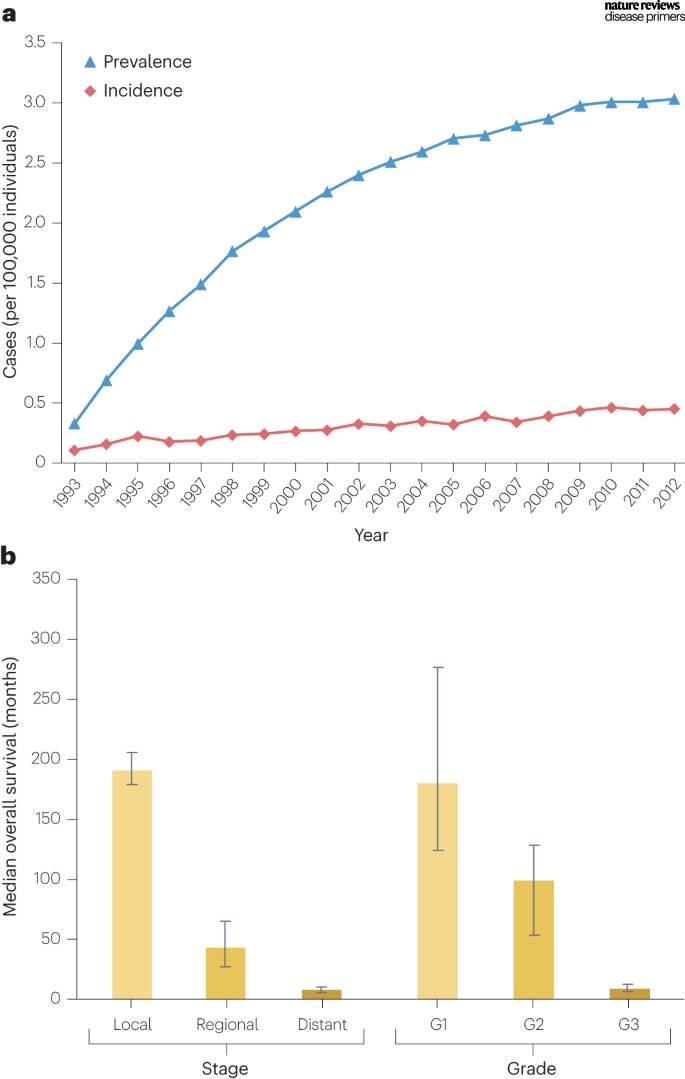Our NEW Primer on Gastric neuroendocrine neoplasms is live today! 
By <a href="/GLambertiMD/">Giuseppe Lamberti</a>, Panzuto, Pavel, O’Toole, Ambrosini, Falconi, Garcia-Carbonero, <a href="/RachelRiechelm2/">Rachel Riechelmann</a>, Rindi &amp; Campana. 

Check it out here: 
go.nature.com/4aHikWE