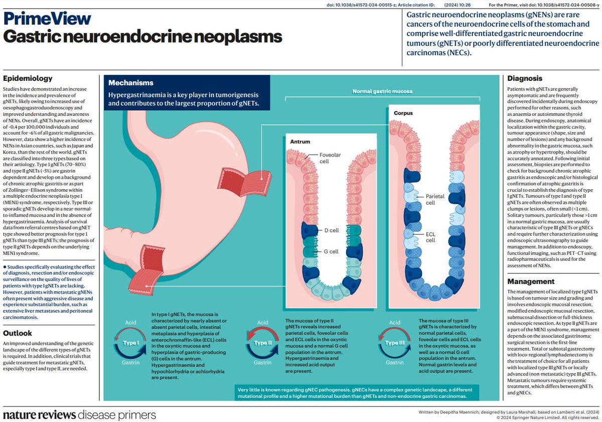 Get Primed on Gastric neuroendocrine neoplasms with our NEW PrimeView! FREE to download this week! go.nature.com/3PZyfYi