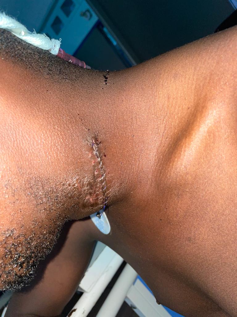 anatheonest's tweet photo. Hii ni moja ya picha ya majeruhi wa Risasi za moto walizopigwa wananchi wa Murongo,jimbo la kwa tuhuma na hisia kuwa wanavusha Kahawa kwenda Uganda,makumi ya raia wamelemazwa viungo na kuuawa kwa Risasi kwa kubambikiwa hizo tuhuma!
Hii ndo haki Jinai? https://t.co/ta8AAubpO1