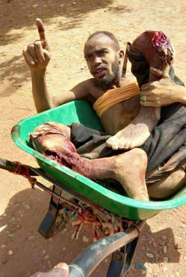 جرائم قصف الطيران في دارفور...
أللهم لا ترفع للكيزان راية وأجعلهم لمن بعدهم عبرة وآية. امين