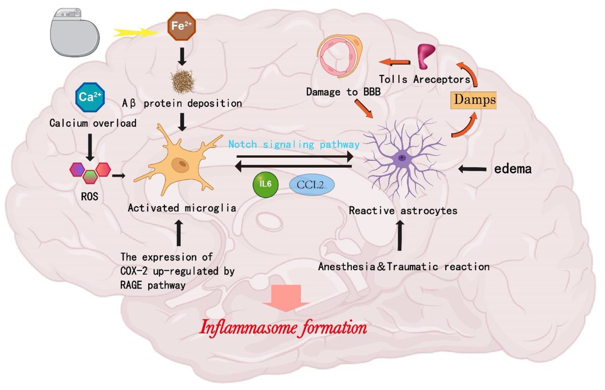 #WorldParkinsonsDay2024 Insights into Advanced Neurological Dysfunction Mechanisms Following DBS Surgery in Parkinson’s Patients: #Neuroinflammation and Pyroptosis 👥By Dr. Hao Meng et al. 🏦Jilin University 🔗mdpi.com/1467-3045/45/5… @MDPIOpenAccess #DBSSurgery