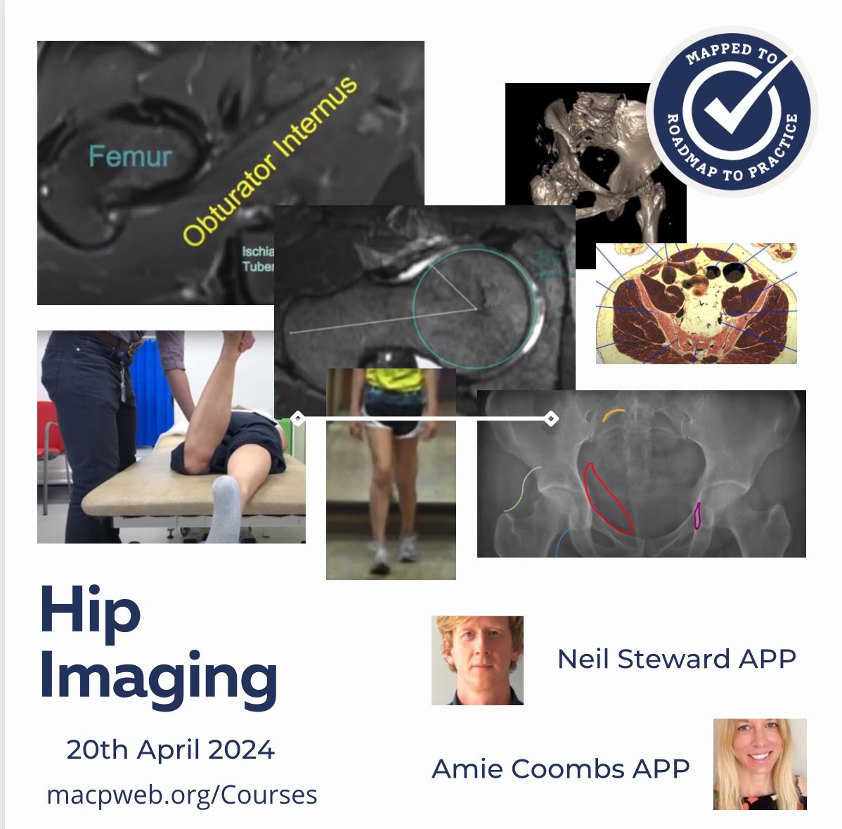 This fantastic 1 day online hip imaging course is back by popular demand with @neilstewart101 and @AmieCoombs2 book here now to secure your space! macpweb.org/events/284/int…