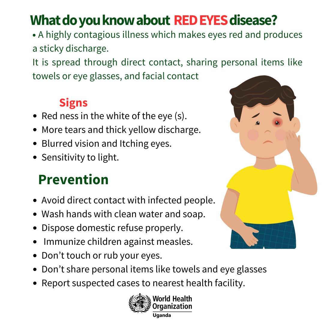 Over 950 pple in Uganda have contracted conjunctivitis - red eye disease in 2024. This disease is preventable, but if untreated, can lead to blindness. To Improve decision-making, @WHO advocated for integration of eye health indicators in health mgt info systems. ##WorldHealthDay