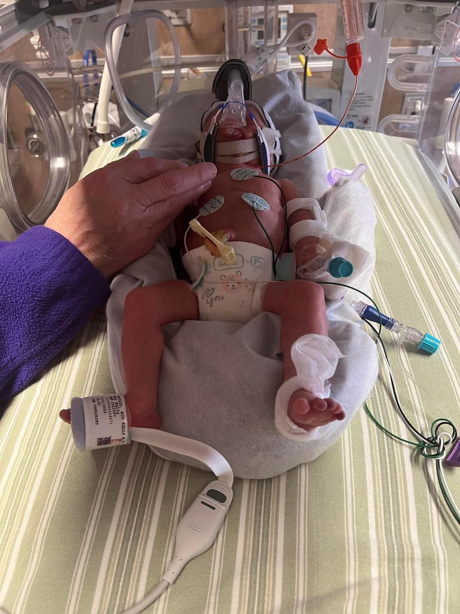 NickPaulus's tweet photo. It’s Mikey’s 1st Birthday!!!

From a 3lb 9oz, 10 wk preemie to a happy, healthy little boy.. This has been the best year of my life

@KPaulus0328 &amp; I are so blessed to be your parents https://t.co/AXR9fFlsci
