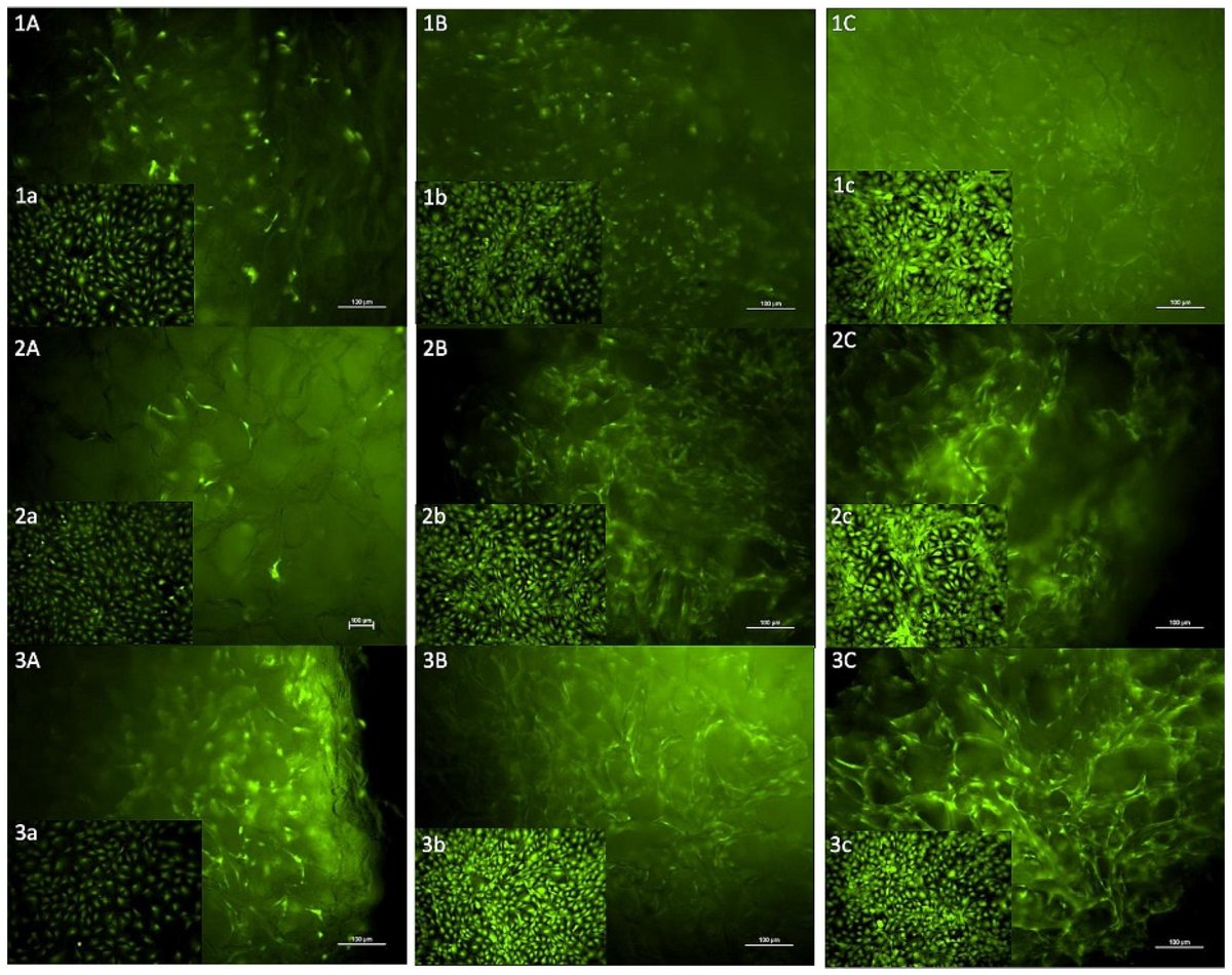 🌟 Excited to share the Issue Cover of Bioengineering, Volume 9 Issue 7: Effects on Tissue Integration of #Collagen #Scaffolds Used for Local Delivery of Gentamicin in a Rat Mandible Defect Model. Welcome to view the paper here👉 : mdpi.com/2306-5354/9/7/…. #surgical #infections