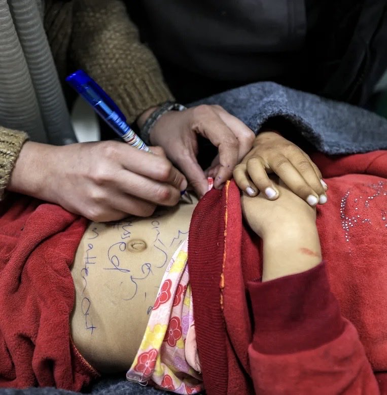 #StopArmingIsrael
#StopTheGenocideInGaza
If given the chance to grow up, maybe she would have wanted a beautiful flower tattoo on her shoulder. Now a nurse writes her name on her tiny dead body. 
[Sidal Abu Jamea, a 7-year-old Palestinian girl killed in an Israeli bombardment.]