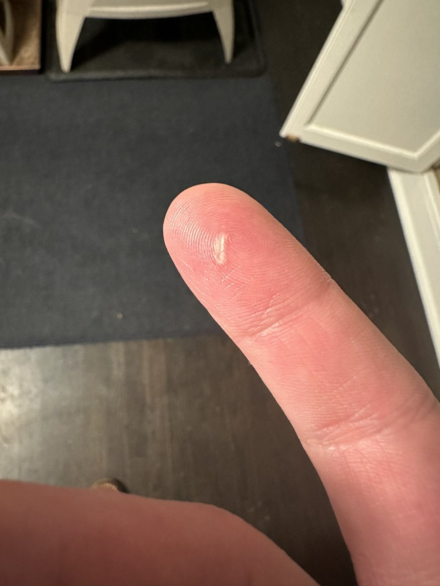 Lee M. Ocuin MD, FACS tweet media