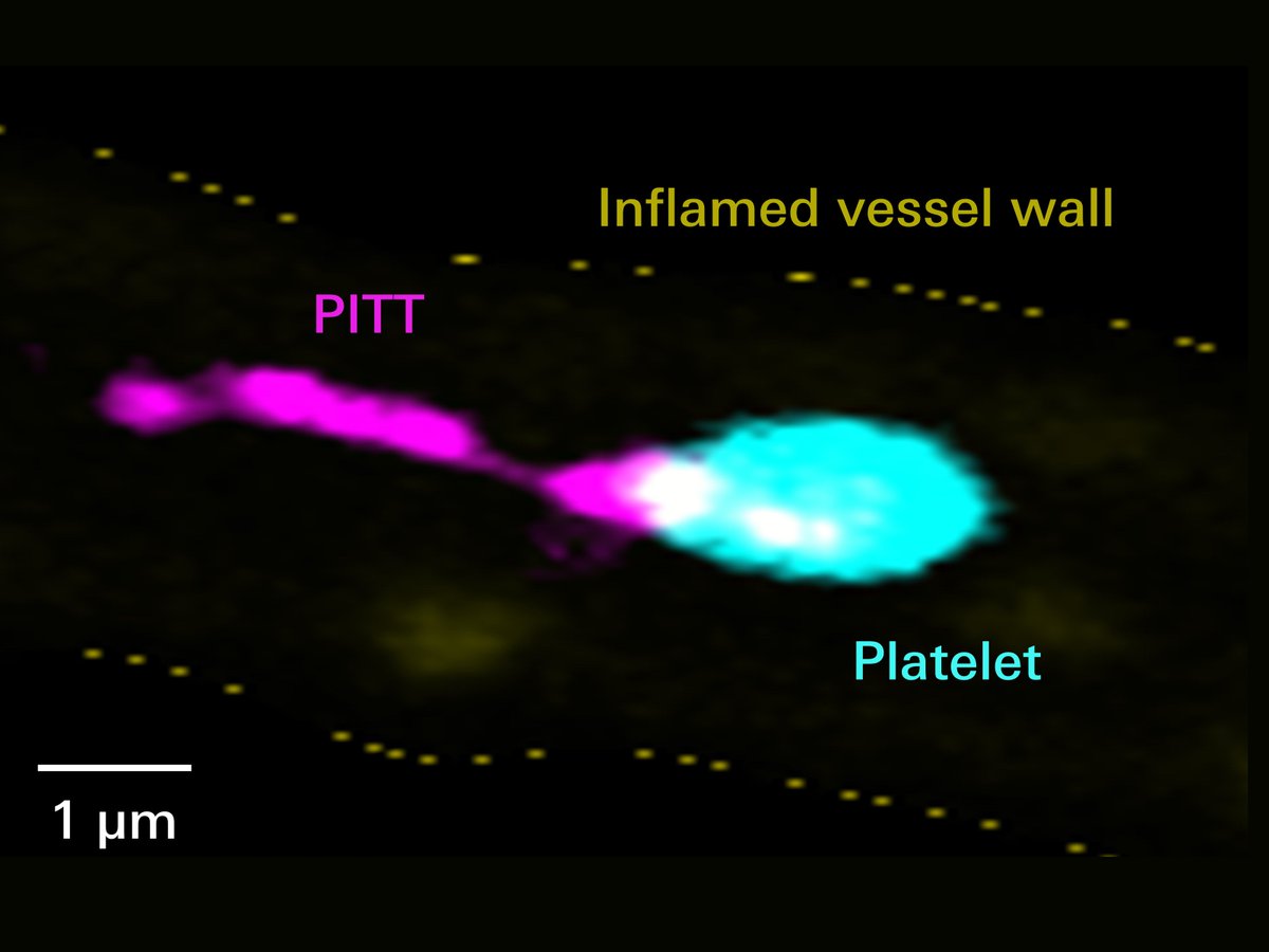 Congrats 👏🏼Further information on this great project about PITT - platelet-derived integrin- and tetraspanin-enriched tethers - can be found here, in English: idw-online.de/de/news831786 and in German: ukw.de/aktuelle-meldu…