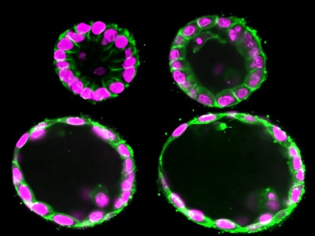 Hollow #organoids can be shaped & inflated by external electrical stimulation – applications in eg #bioengineering #developmentalbiology. Image & research by @GawoonS & Isaac B. Breinyn et al @DJCohenEtAl lab @Princeton in @NatureComms. On bpod.org.uk/archive/2024/4…