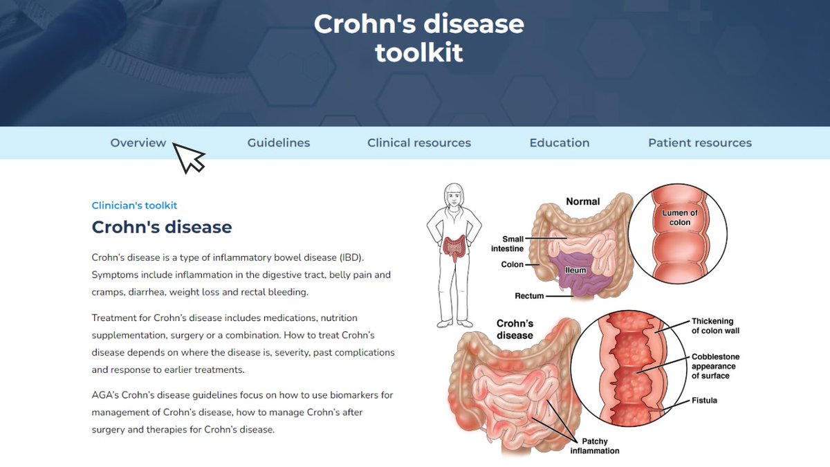 🔔 We just released our all new Crohn’s disease toolkit so you can have all our clinical guidance, continuing education resources, patient education and FAQs all at your fingertips. Check it out: ow.ly/1ct950RbHkm