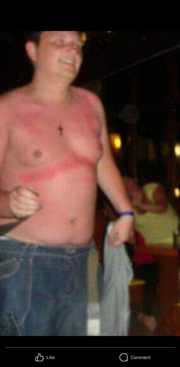 I've no idea why I've got skin cancer. Me 10 years ago.