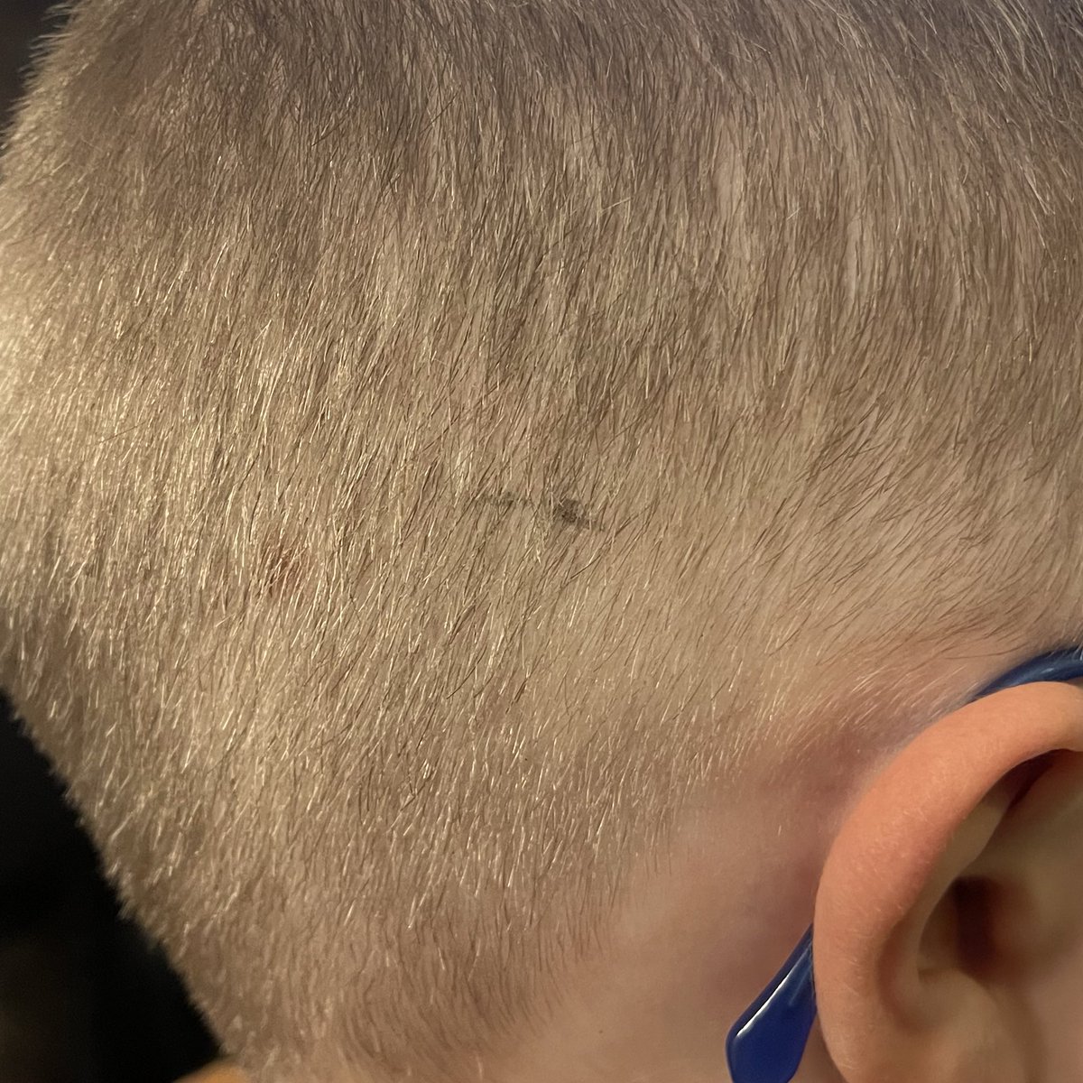 My kid came home with a pen mark on his head. I asked how it happened and he told me he did it because he wanted to see what he looked like with dark hair, but knew it would take too long this way. Later he told his brother it was time for Plan B. GOOD GOD, WHAT IS PLAN B? 😭