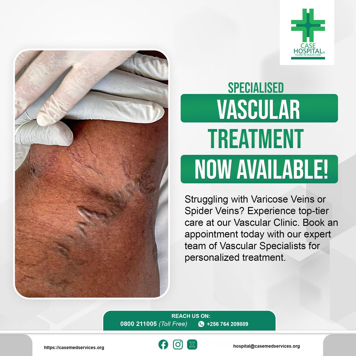 Are Varicose Veins or Spider Veins bothering you? Discover unparalleled care at our Vascular Clinic. Book an appointment now with our skilled Vascular Specialists for tailored treatment. 

#VascularCare #VeinHealth #SpecializedTreatment