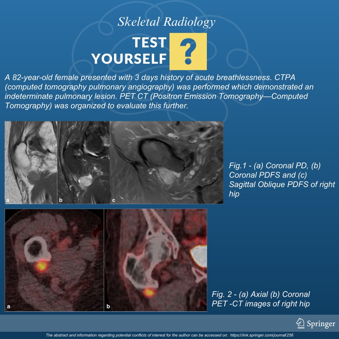 Test your ability with this interesting case from #TestYourself. Can you guess what it is? Bookmark this and come back later to see the final diagnosis! 

#SkeletalJournal #MSKRad #Pathology #orthotwitter #radres