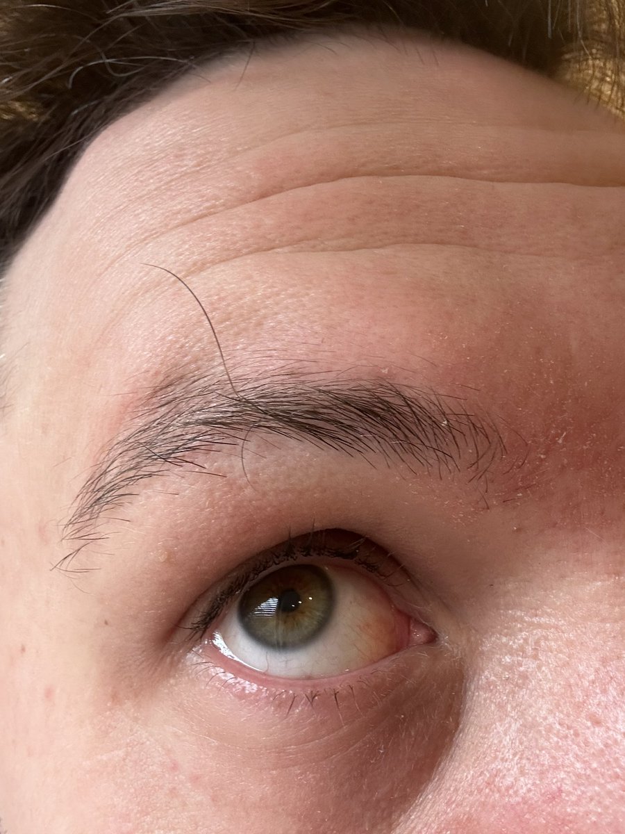 Hello?! You weren’t here yesterday! #gettingold #eyebrows