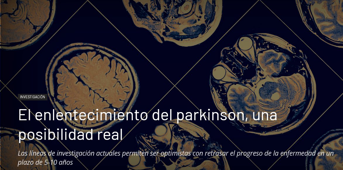 El enlentecimiento del Parkinson, una posibilidad real: gacetamedica.com/investigacion/… Hoy es el Día Mundial del #Parkinson #Neurologia