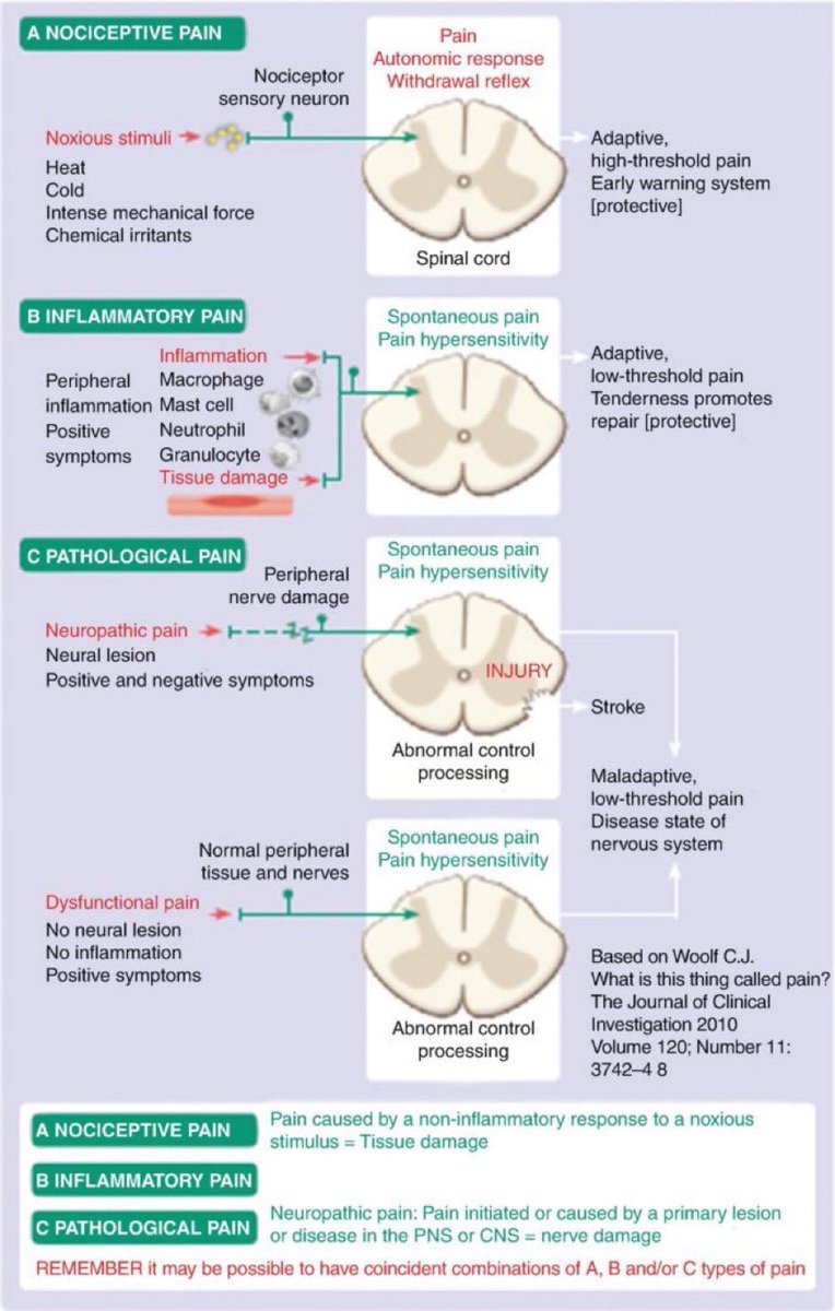Omid_HopeUni's tweet photo. Types of pain and their features👇🏼

Nociceptive 👉🏾 caused by a non-inflammatory response to a noxious
stimulus (tissue damage)

Inflammatory 👉🏾caused by tissue inflammation 

Pathological/Neuropathic👉🏾initiated or caused by a primary lesion

#pain 

https://t.co/hq0oQdE4Dy https://t.co/8wA3J1oSpF