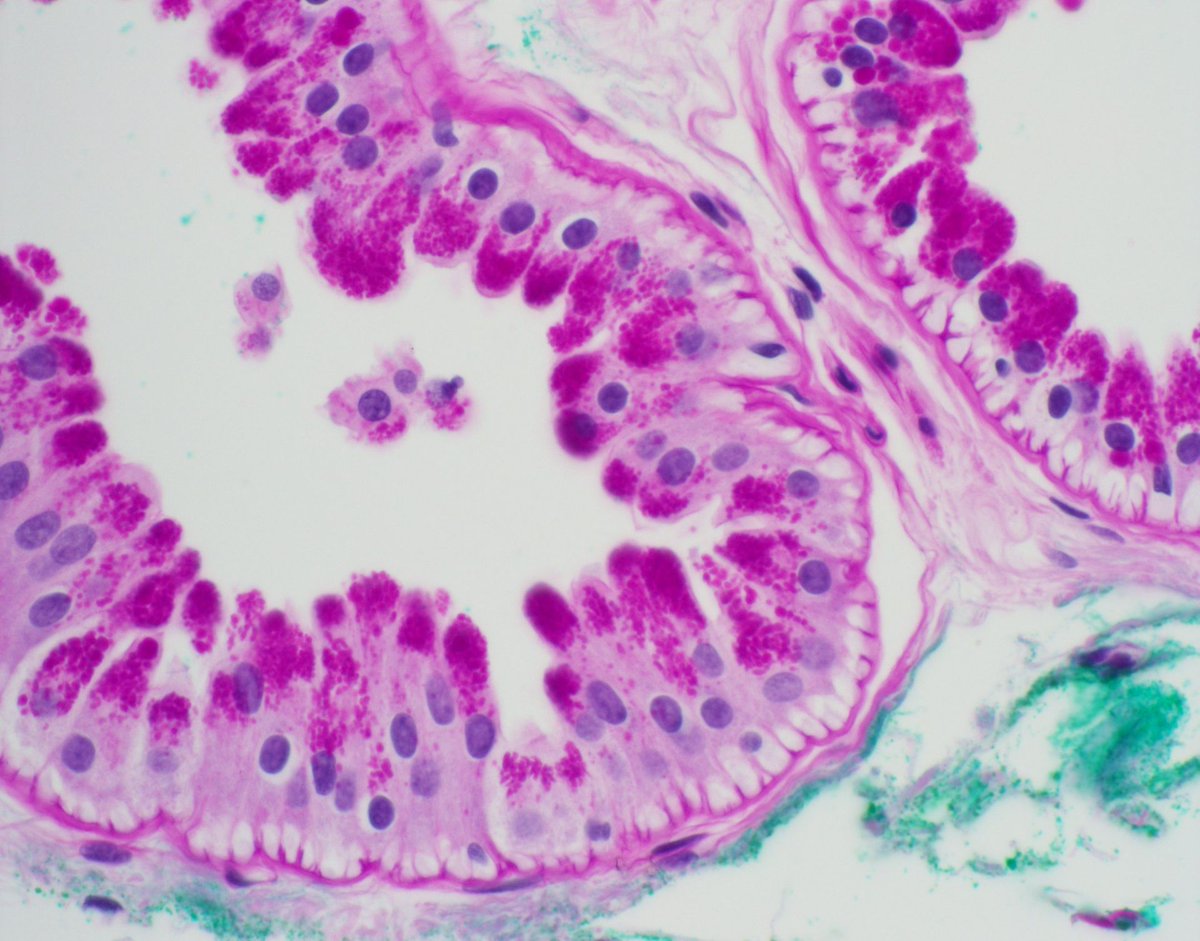 What normal skin structure is this? Bonus point if you can name the stain (it's not H&E!). Answer & more pics here: kikoxp.com/posts/7838. #pathArt #histology #pathology #pathologists #pathTwitter #dermpath #dermatology #dermatologia #dermtwitter #usmle