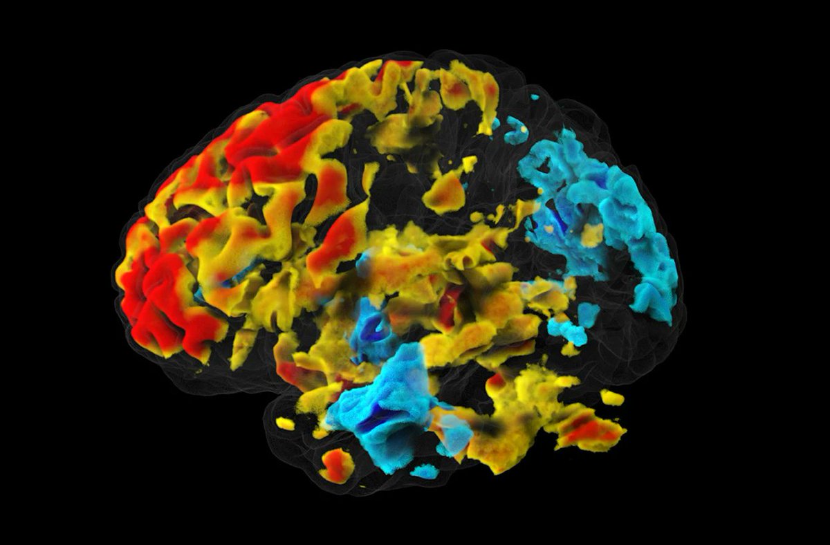 The DIANA technique sparked excitement from neuroscientists. But two new papers have cast doubt over the results. This fMRI technique promised to transform brain research — why can no one replicate it? nature.com/articles/d4158…