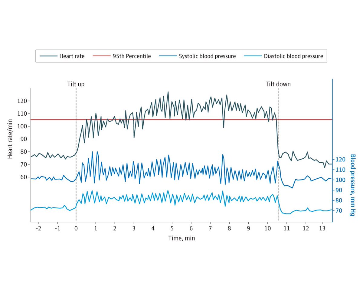 This Diagnostic Test Interpretation uses a patient case to illustrate tilt table testing, useful for evaluating patients with syncope of unknown cause or postural orthostatic tachycardia syndrome (POTS). ja.ma/4aBO5AM