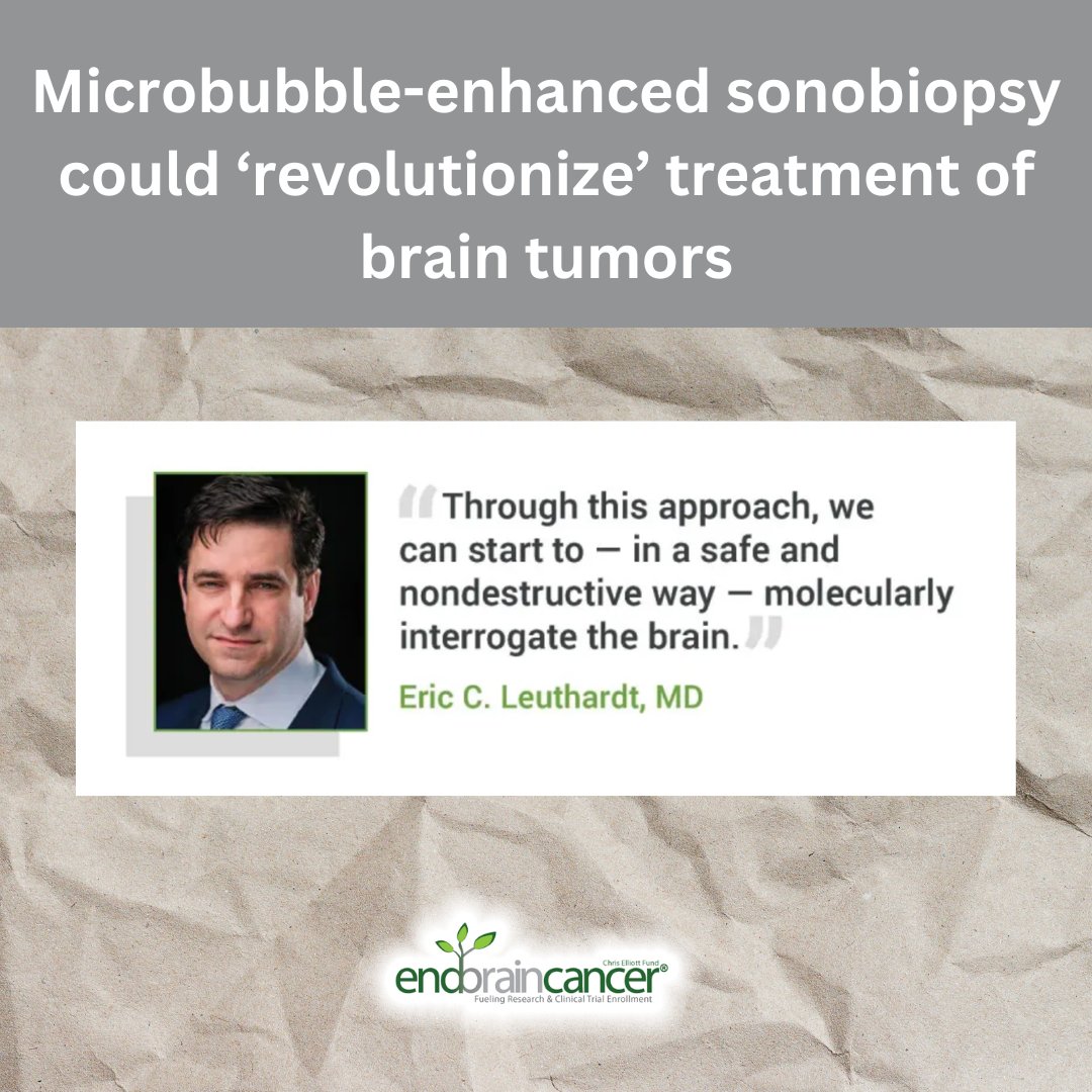 Focused ultrasound could provide clinicians a safer alternative in diagnosing, monitoring and treating patients with brain tumors compared with biopsy, according to findings published in npj Precision Oncology. Learn more at ecs.page.link/Wi16g #BrainTumor #EBCI