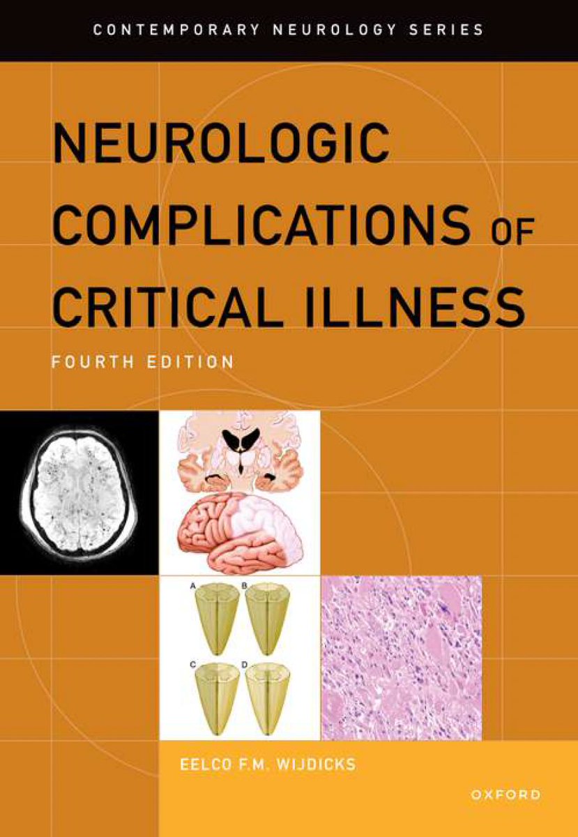 ⚡️🧠 Amazing book for neurologists by @EWijdicks!

It has the flow of a novel and gives pearls and practical common sense advice about diagnosis, management and prognosis in every chapter.

#FOAMcc #NeuroCritCare #FOAMed #EMCCM #NeuroICU #NeruroMonitoring #IntensiveCare…