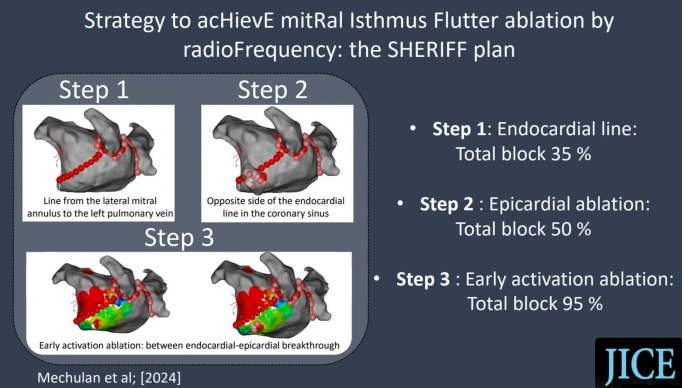 🚨Latest #OpenAccess Article in
@JICE_EP 

Strategy to Achieve Mitral Isthmus Flutter Ablation by Radiofrequency: the SHERIFF Plan

🧐📖doi.org/10.1007/s10840…

by Alexis Mechulan, Pierre Dieuzaide, Angélique Peret, Thibaud Vaugrenard, Sophiane Houamria, Frederic Pons, Lyassine…