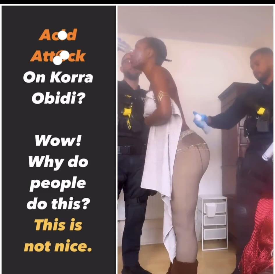 Korra obidi have just been att@ cked with an Ac!d and was almost st@ b*ed in her apartment in UK ….She is currently hospitalized and receiving Treatment 💔