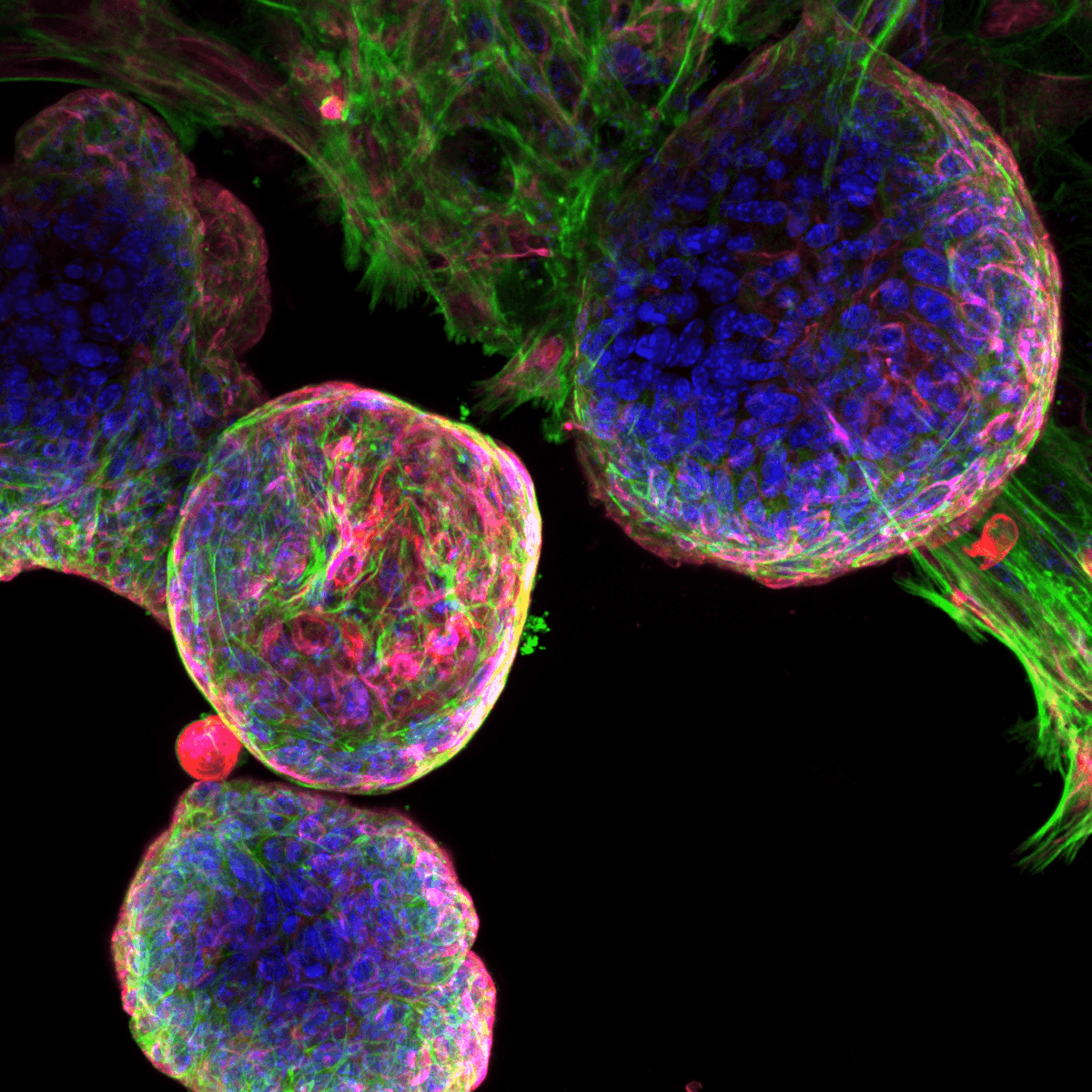 ProstateCell's tweet photo. Don't miss out on joining the annual #StemCellfie contest from @STEMCELLTech! From now until 11:59 am PDT April 19th, submit your best #cellfie: https://t.co/kD05EHO0K8
Need inspiration? View this beautiful #ProstateCell image submitted last year! #SciArt π¨πΈ https://t.co/YoxG6m0e9N