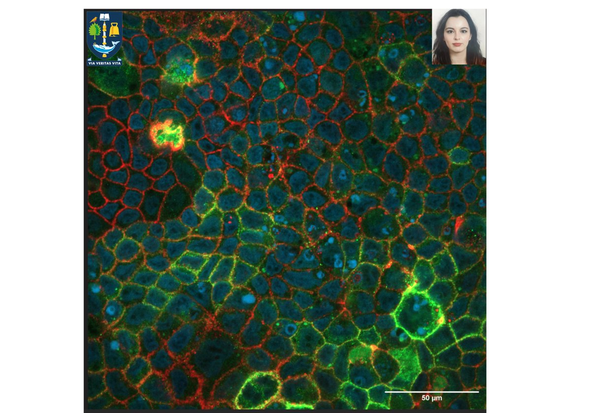 Check out an amazing image of CaCo-2 intestinal epithelial cell line staining by our visiting student from Italy (Politecnico Milano), Alessandra Maria Anna Rando. 
Aim:  Tuning the stiffness of polyacrylamide gels to develop a biomimetic intestinal model.