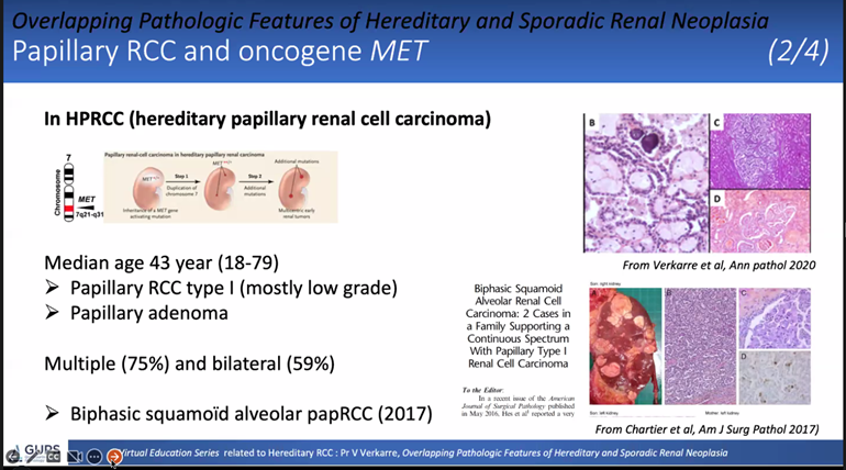 Samson W. Fine, MD (@rovingatuscap) on Twitter photo Dr. Virginie Verkarre presents Overlapping Pathologic Features of Hereditary & Sporadic Renal Neoplasia at <a href="/GU_Path_Society/">GU Pathology Society (GUPS)</a> Virtual Education Series event HAPPENING NOW!! #gupath #kidneycancer <a href="/manjuaron/">manju aron</a> <a href="/Shounak_Gupta/">Sounak Gupta</a> <a href="/drmehrarohit/">ROHIT MEHRA</a> Dr. Virginie Verkarre presents Overlapping Pathologic Features of Hereditary & Sporadic Renal Neoplasia at <a href="/GU_Path_Society/">GU Pathology Society (GUPS)</a> Virtual Education Series event HAPPENING NOW!! #gupath #kidneycancer <a href="/manjuaron/">manju aron</a> <a href="/Shounak_Gupta/">Sounak Gupta</a> <a href="/drmehrarohit/">ROHIT MEHRA</a>