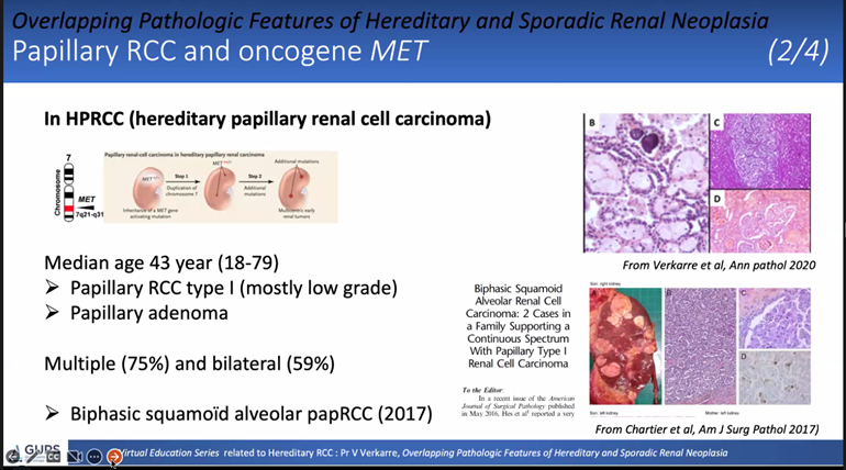 Dr. Virginie Verkarre presents Overlapping Pathologic Features of Hereditary & Sporadic Renal Neoplasia at @GU_Path_Society Virtual Education Series event HAPPENING NOW!! #gupath #kidneycancer @manjuaron @Shounak_Gupta @drmehrarohit