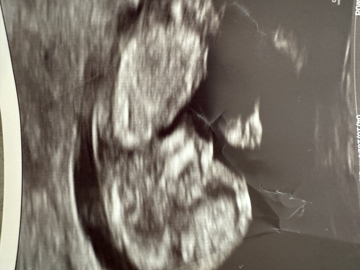 Hubert Thieblot tweet media