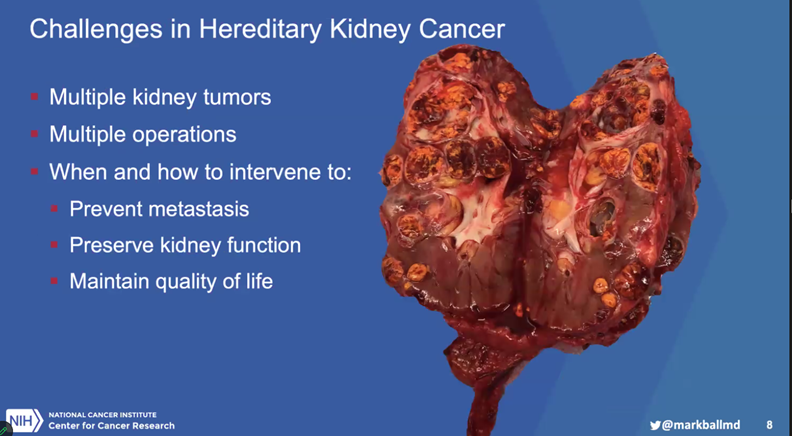 Samson W. Fine, MD (@rovingatuscap) on Twitter photo Dr. Mark Ball <a href="/markballmd/">Mark Ball, MD, FACS</a> Urologic Oncologist <a href="/theNCI/">National Cancer Institute</a> presents Surgical Intervention for Hereditary RCC #kidneycancer at <a href="/GU_Path_Society/">GU Pathology Society (GUPS)</a> Virtual Education Series event HAPPENING NOW!! #gupath
<a href="/Shounak_Gupta/">Sounak Gupta</a> <a href="/drmehrarohit/">ROHIT MEHRA</a> <a href="/manjuaron/">manju aron</a> Dr. Mark Ball <a href="/markballmd/">Mark Ball, MD, FACS</a> Urologic Oncologist <a href="/theNCI/">National Cancer Institute</a> presents Surgical Intervention for Hereditary RCC #kidneycancer at <a href="/GU_Path_Society/">GU Pathology Society (GUPS)</a> Virtual Education Series event HAPPENING NOW!! #gupath
<a href="/Shounak_Gupta/">Sounak Gupta</a> <a href="/drmehrarohit/">ROHIT MEHRA</a> <a href="/manjuaron/">manju aron</a>