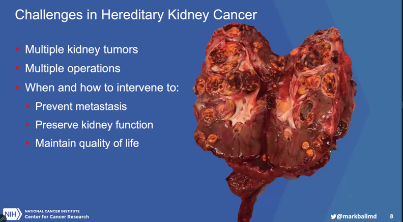 Dr. Mark Ball @markballmd Urologic Oncologist @theNCI presents Surgical Intervention for Hereditary RCC #kidneycancer at @GU_Path_Society Virtual Education Series event HAPPENING NOW!! #gupath @Shounak_Gupta @drmehrarohit @manjuaron