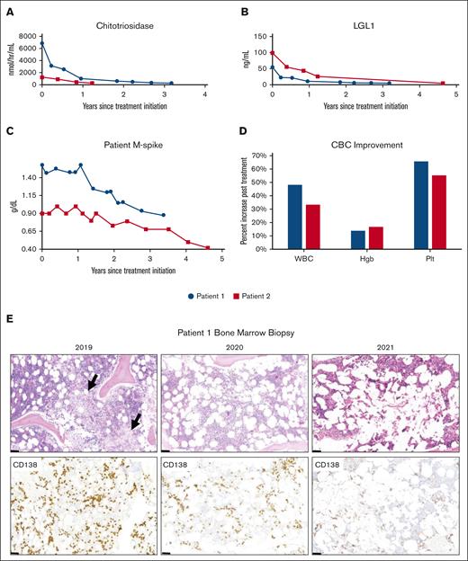 Regression of smoldering myeloma with treatment of Gaucher disease
ow.ly/6IFe50RbGa7 #immunobiologyandimmunotherapy #lymphoidneoplasia