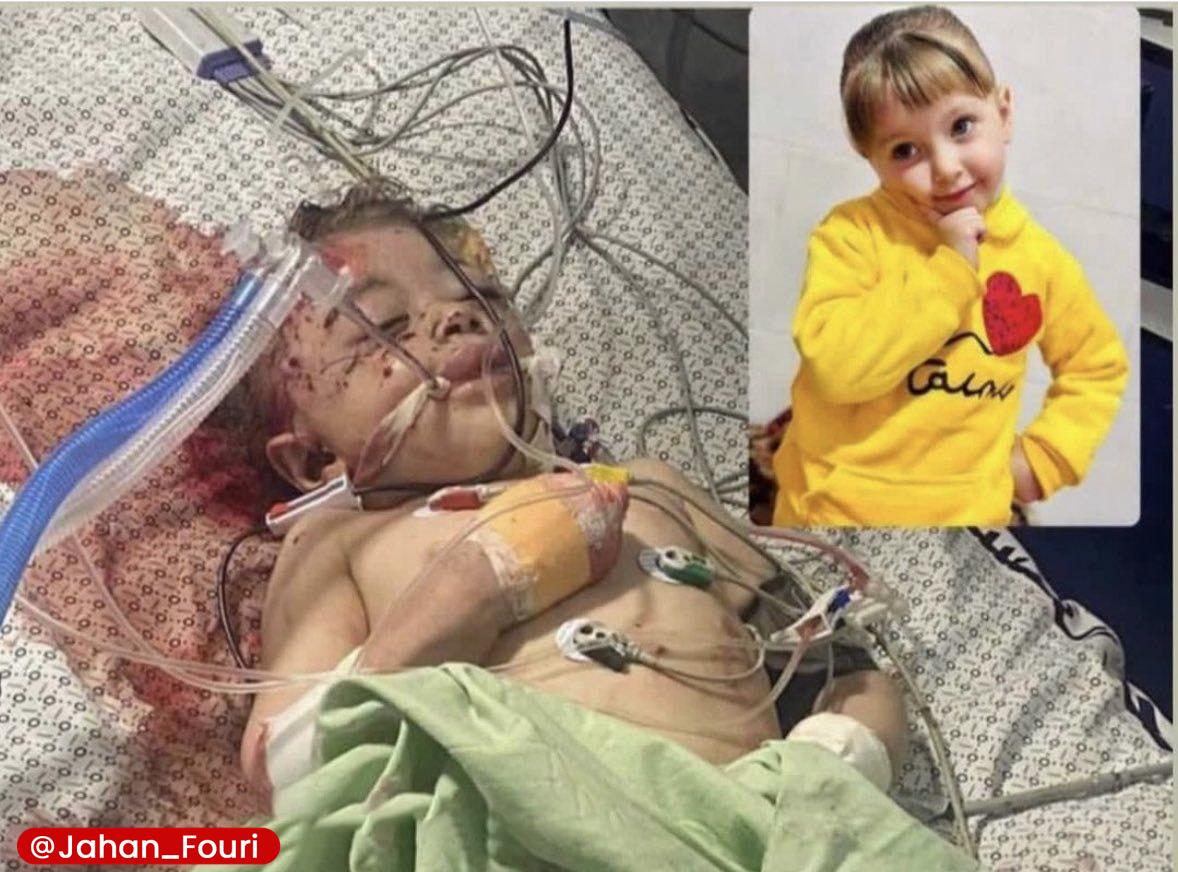 ⚡️The only survivor of the Israeli massacre of Hamas chairman Ismail Haniyeh's family is his 4-year-old granddaughter, who is in critical condition.