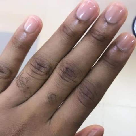 Finger nails thread?